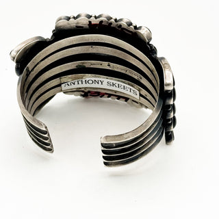 Anthony Skeets Masterpiece Cuff